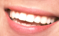 Eldorado Dental Gentle, Expert Dental Services
